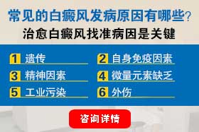 常见白癜风的发病原因有哪些 常见白癜风的发病原因有哪些